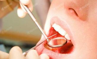 曝2024年上海儿童牙科上榜清单前十的口腔医院，看牙齿都比较好