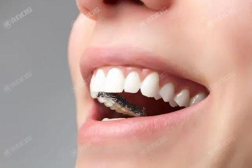 上海牙齿矫正哪个医院好？速来参考2024十大牙科排行榜