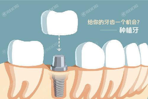 哈尔滨2024种植牙十大口腔医院排名，这十家牙科正规实力好值得推荐