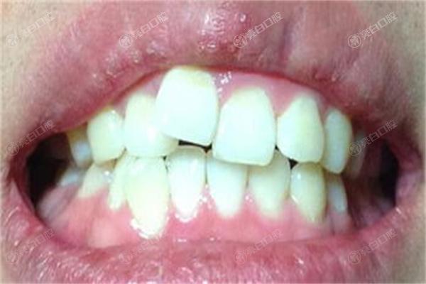 上海十大牙齿矫正口腔医院排名