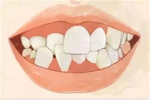 上海十大牙齿矫正口腔医院排名