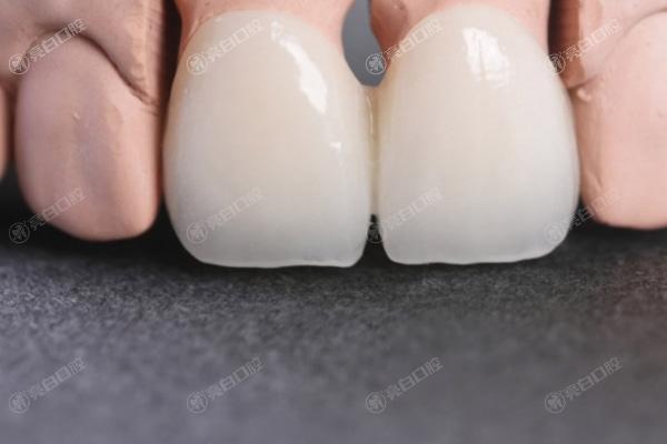 桂林全瓷牙排名前十的口腔医院，评分高价格靠谱的全瓷牙排名榜找到了