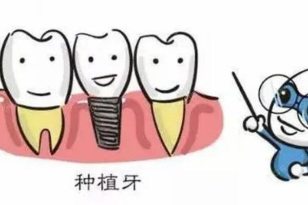 烟台国内种牙好的牙科医院排行！揭秘2024年烟台种植牙排名前十的口腔医院