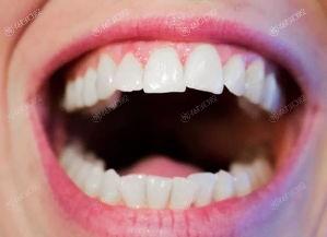 来看看大连佳美豪森名家口腔诊所口腔项目价格一览表 做拔牙300/种植牙3000挺便宜