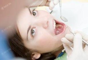 揭秘贵阳口腔医院假牙义齿手术价格表更新 国产树脂牙200起，收费透明不坑人