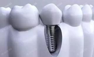 刷新合肥口腔医院补牙价格一览表 做3M树脂充填300/VOCO纳米树脂充填300挺便宜