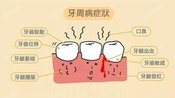 揭秘杭州口腔医院补牙收费贵吗 上颌智齿拔除术、瓷化树脂充填、VOCO纳米树脂充填、进口玻璃离子充填部分有折扣