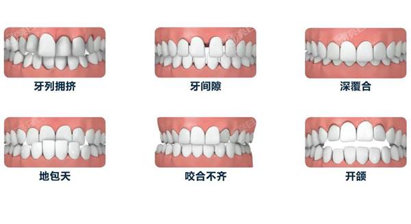 天津牙科医院收费高吗?不高,拔智齿/补牙/种牙/整牙价格明细公开