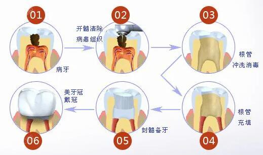 瑞尔齿科价目表2024已出,种植牙2580+/牙齿矫正4500+收费并不贵