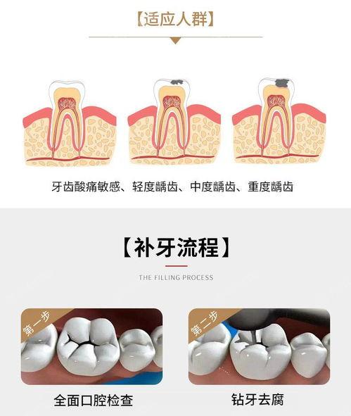 2024杭州补牙齿医院排名榜前三揭秘 想找杭州哪里补牙齿靠谱评价好看过来