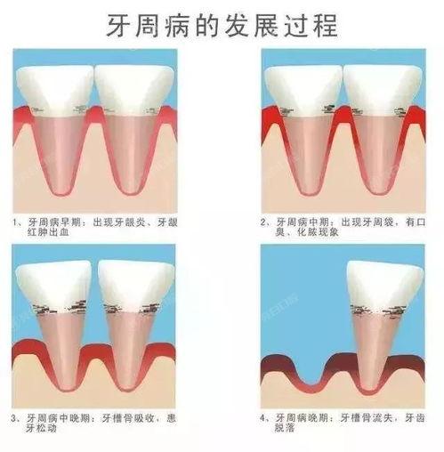 深圳正畸哪里靠谱评价好？速览这十家正规评价靠谱的口腔医院