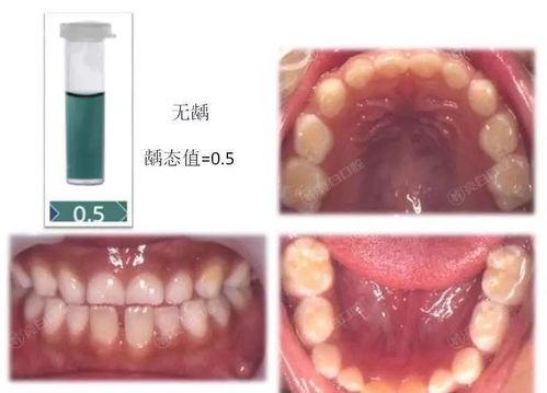 遵义技术好的正畸医院排名前三,看遵义哪家正畸好技术靠谱