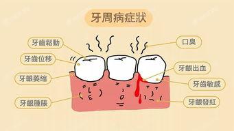 北京评价好的智齿医院排名前七,看北京哪家智齿好评价靠谱