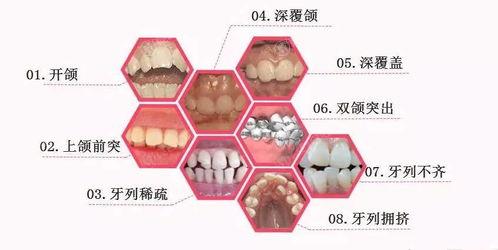 宿迁儿童牙科到哪个医院好？这五大口腔医院靠谱环境好