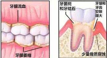 北京2024口腔医院六大排行上线,一键查询北京洗牙哪里靠谱技术好