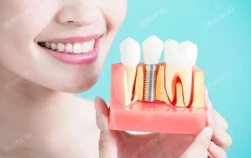 2024年连云港种植牙医院排名榜更新，排名前五的牙科花落谁家？
