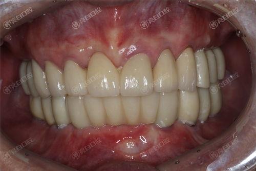 泸州靠谱实力好的牙科医院排名，是种植牙正规实力好的牙科诊所