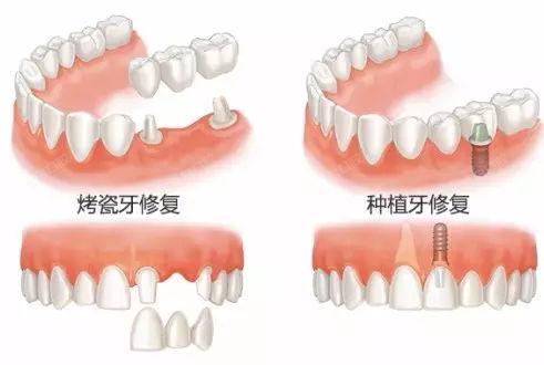 2024荆门全瓷牙口碑好的医院公布，排名前四的全瓷评价好