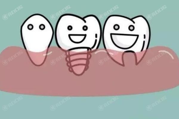 杭州牙齿种植排名前十的口腔医院，是种植牙正规服务好的牙科诊所