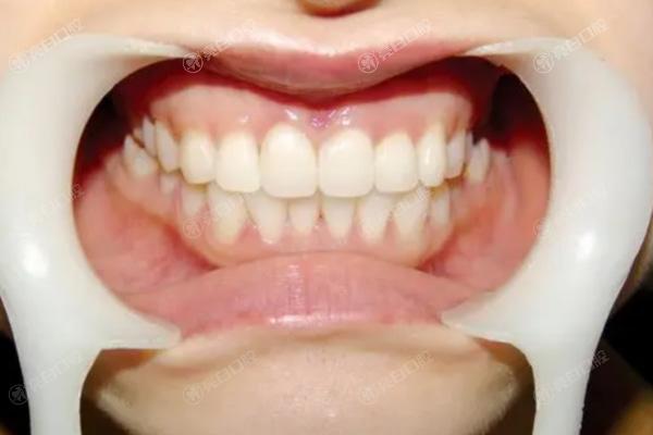菏泽全瓷牙五大口腔医院排名榜！评选2024年菏泽全瓷牙技术水平高的牙科诊所