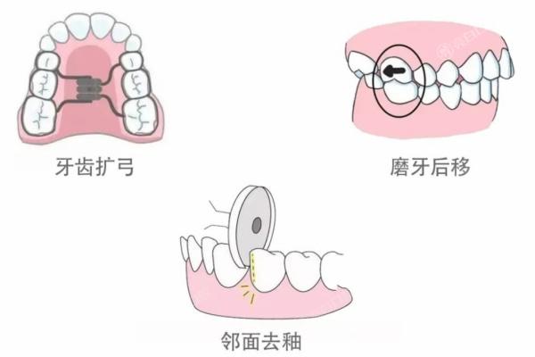 杭州正畸十大私立口腔医院，2024杭州牙齿矫正价格好的医院排名曝光