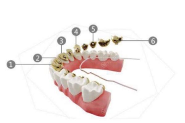 新版北京牙齿矫正价格价目表查询!不同类型正畸技术+品牌矫正器价格分享