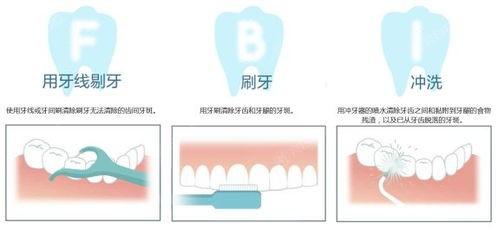 一览黑龙江哈尔滨兔兔熊口腔口腔项目要多少钱 种牙3000+半口种植牙50000+洗牙100+