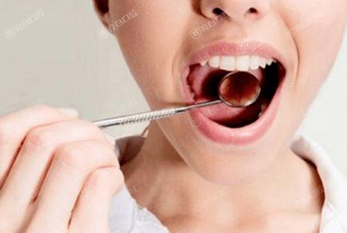 揭晓河南郑州上工口腔口腔项目收费标准一览 洗牙/补牙/种牙/半口种植牙费用不贵
