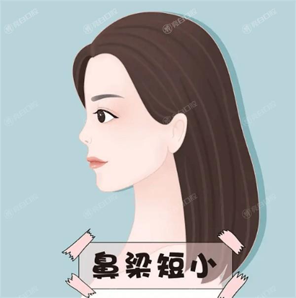 福州自体软骨隆鼻正规医美医院排名公布 有名的是世纪、久植因美、新时代