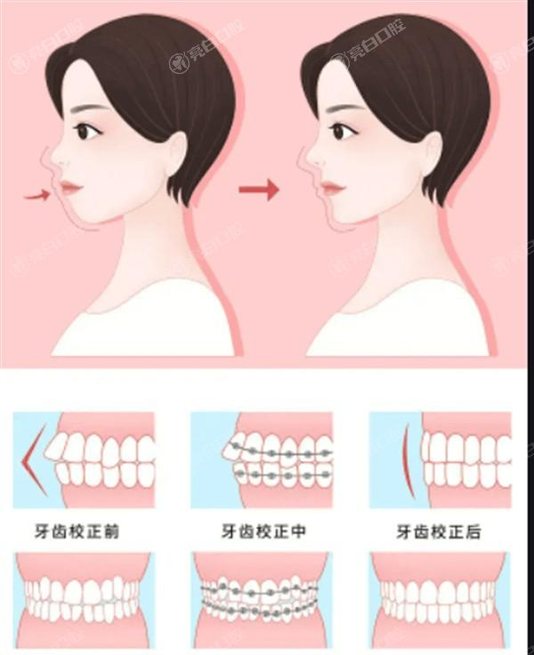 惠州白瓷娃娃好的医院排名 排名上百佳伊丽莎白妇产/诗璐/中信医院挺出名